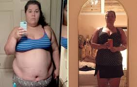 Gastric bypass additionally affects how metabolic rate changes with weight loss. 9 Things I Wish I Knew About Gastric Bypass Surgery Before I Had It Women S Health
