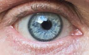 Limbal Ring Wikipedia