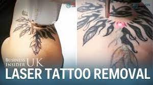 Warm friendly studio,all styles,custom work,award winning artists. 10 Best Clinics For Laser Tattoo Removal In New Zealand 2021 Prices