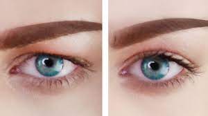 If you are looking into getting advice about botox / brow lifts for hooded eyes, i had a good. How To Get Rid Of Hooded Eyelids Without Surgery Youtube