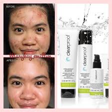 Today i have a special post for you made possibly by the lovely people from mary kay. Twitter à¤ªà¤° Maryk Emillyn Testimoni Set Clear Proof Gambar Menceritakan Segalanya Jom Calling2 Free Consultation Tau Wanie 0102490396 Future Sales Director Marykay Malaysia Marykaymalaysia Marykaykl Marykaypuchong Jerawat