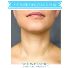Cosmetic News The Best Non Surgical Neck Treatments Schweiger Dermatology Group