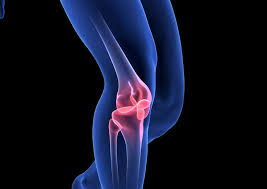 Die fasern dieser bänder stabilisieren das kniegelenk. Knie Verdreht Symptome Behandlung Und Erste Hilfe Heilpraxis