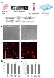 17 18 ele comentou que bacharelou em subversão em moscou durante o seu exílio, mas que ao longo do tempo e devido a certos fatos históricos, se desiludiu do socialismo, sustentando em 2014 que o socialismo não fazia mais sentido, pois. Ijms Free Full Text The Mito Qc Reporter For Quantitative Mitophagy Assessment In Primary Retinal Ganglion Cells And Experimental Glaucoma Models Html