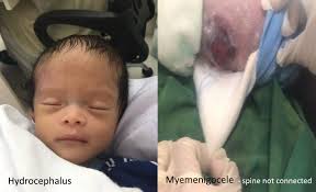 Let's help Kaiden John heal