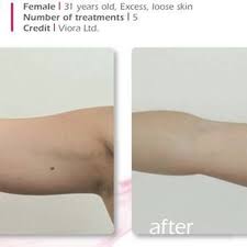 THE BEST 10 Laser Hair Removal near Encino, Los Angeles, CA - Last Updated  September 2023 - Yelp