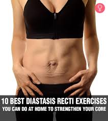 10 best diastasis recti exercises you