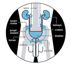 Prostate cancer, for example, has a marker known as psa. Advanced Prostate Cancer Managing Symptoms Prostate Cancer Uk