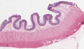 Also known as the uterine tube or the oviduct, the fallopian tube exists as. General Histology Knowledge Amboss