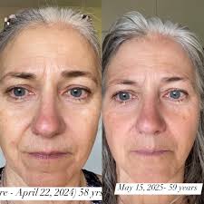 My Liquid Collagen Results : What you can see...zoom in! ❤️ UNDER EYE  WRINKLES ARE ACTUALLY DIMINISHING! 😭😭😭 ❤️ Pores are getting smaller ❤️  Creases around my nose less deep ! ❤️