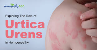 Image result for Urtica urens