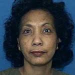 Dr. Olive V. Chung-James, MD