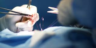 Image result for how to sue a doctor for wrong treatment