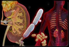 Unii copii au predispozitie la infectii urinare din cauza unor defecte anatomice ale ureterelor. ScapÄ De InfecÈia UrinarÄ FÄrÄ Medicamente Secretele Com