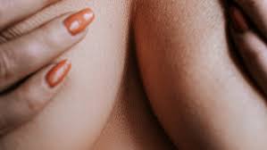 Image result for heat rash under breasts