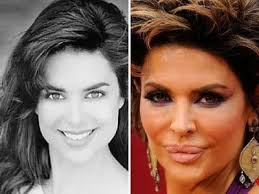 Bad Celebrity Plastic Surgery Bad Celebrity Plastic Surgery Celebrity Plastic Surgery Plastic Surgery Gone Wrong