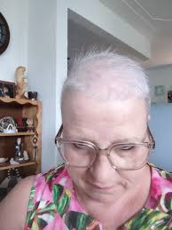 Before chemo and after growing my hair back 😊🙏😊