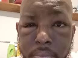 Fundraiser by Matthew Stringer : Help with bills and medical expenses