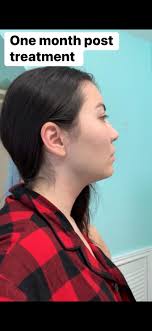 Did any of you get double chin all of a sudden around 35 weeks pregnant?  Lol I don't see that much of a difference in my face, like it's swollen I  mean,