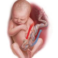 Umbilical cord blood gas analysis at delivery: How And When Umbilical Cord Gas Analysis Can Justify Your Obstetric Management Mdedge Obgyn