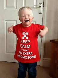 Love This Down Syndrome Cute Kids Kids My Love