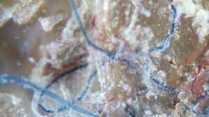 What are morgellons disease symptoms and signs? M3smpvgfp6lldm