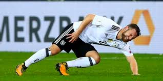 Create and send your own. Shkodran Mustafi Could Be Completely Bollixed Arseblog News The Arsenal News Site