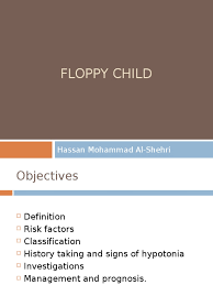 Image result for Floppy Infant