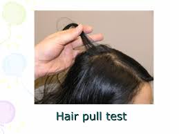 Image result for Hair Pull Test