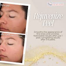 Broome Nurse Practitioners Skincare