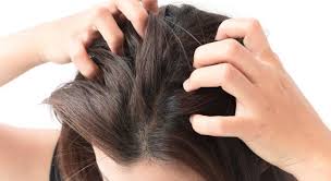 Wenn Trockene Kopfhaut Zum Problem Wird Ursachen Und Losungen In 2020 Juckende Kopfhaut Trockene Kopfhaut Haut