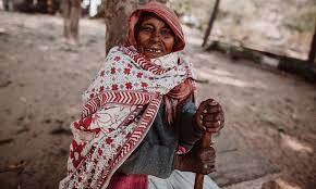 We work directly with communities in bangladesh, india and zimbabwe . Krankheitsbild Der Lepra Dahw De