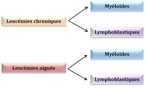 Aussi appelée leucémie lymphocytique chronique. Les Quatre Types De Leucemies Pact Onco
