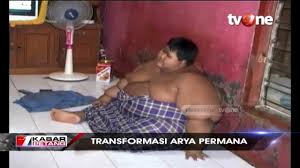 Arya permana is the former world's heaviest living child, weighing at 192 kilograms as of 2016. Indonesia S Fattest Teenager Arya Permana Loses 110kg Amazing Body Transformation With Before And After Pictures Go Viral Latestly