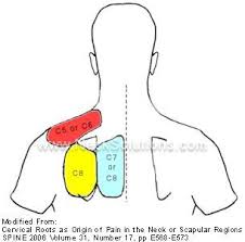 Pin On Neck Back Pain Treatments