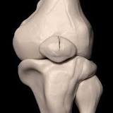 Image result for icd 10 code for fracture right patella
