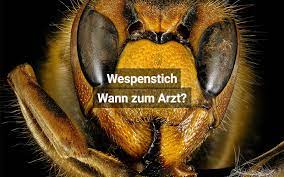 Wespenstich, die eine ärztliche behandlung erfordern, resultieren aus einer allergischen reaktion auf den wespenstachel. Wespenstich Was Tun Und Wann Zum Arzt Praktischarzt Ch