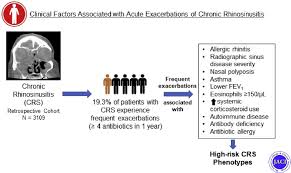 Image result for Rhinosinusitis