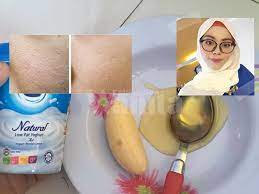 Bagi anda yang sedang menjalankan program diet, yogurt bisa yogurt ini merupakan yogurt asli rendah lemak pilihan tepat bagi anda yang sedang melakukan diet. Masker Campuran Pisang Yogurt Madu Asli Cara Semulajadi Atasi Masalah Pori Terbuka Pada Wajah Mingguan Wanita