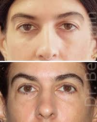 Dr. Benjamín Riesco