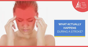 What Actually Happens During A Stroke?