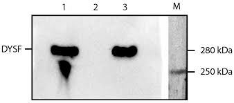 Image result for Black 1996 AAV