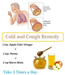 16 Diy Home Remedies For Dry Cough Natural Cough Remedies Cold And Cough Remedies Remedies