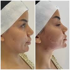 Miliona Aesthetic added a new photo.