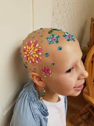 Little girls are just very young women, and beauty matters can't be foreign to them, in spite of their tenderest age. A Little Girl S Hair Falls Out Suddenly Her Parents Are In Complete Shock Confusion When They See A Doctor She Is Bald