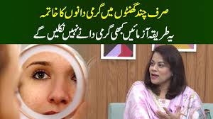 Garmi Dane Khatam Kerny ka tareeqa