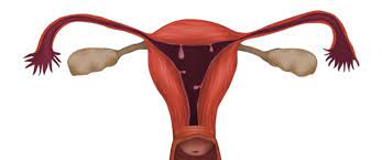 لحمية الرحم دليلك الشامل لتعرف عليها ويب طب