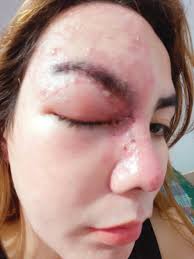 How can I get help with labor and overcome financial difficulties due to  health issues?