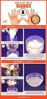 How To Get Rid Of Scabies With Home Remedies Home Remedies For Scabies Home Remedies Scabies