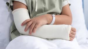 Image result for Fractures in Children